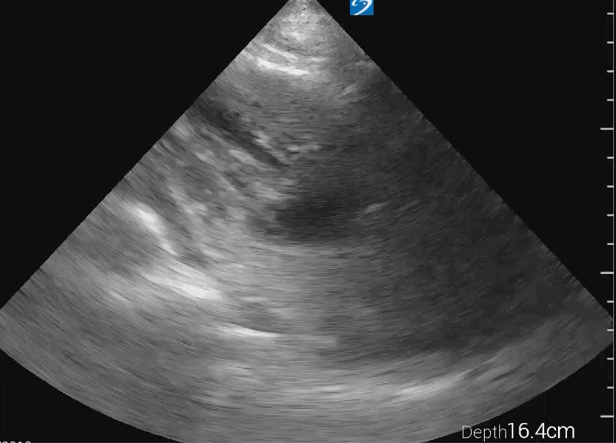 EEU case image missing